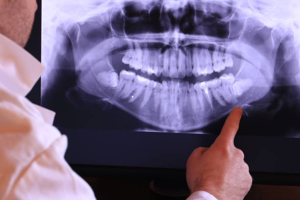 Best Emergency Dental Care for Broken or Chipped Teeth in Thornton, IL