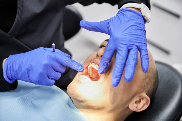 Best Emergency Treatment for Dental Infections or Abscesses in Thornton, IL